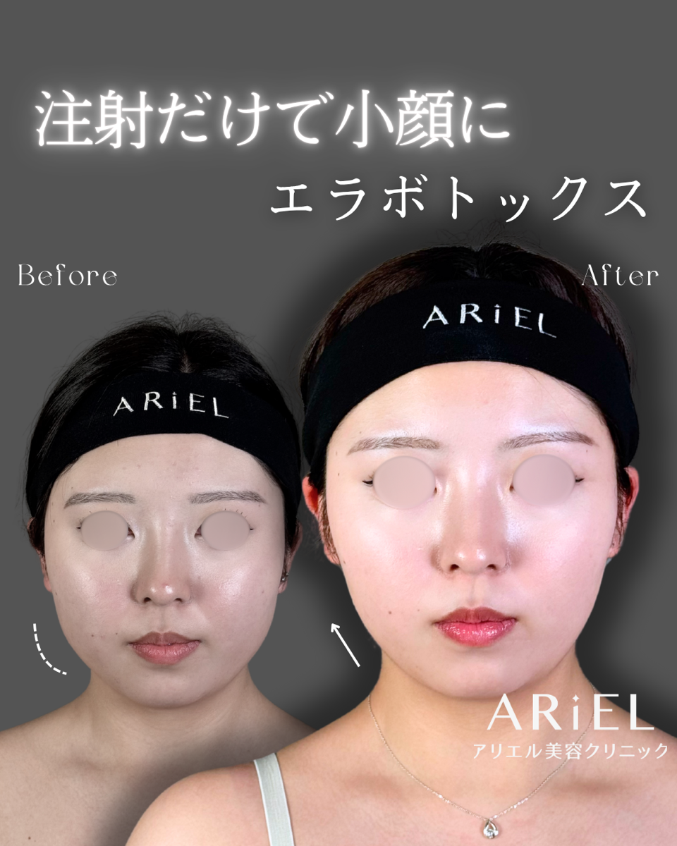 No.9160の症例写真